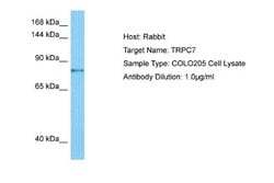 TRP7 Antibody, Novus Biologicals 100 &mu;L; Unconjugated:Antibodies, Polyclonal